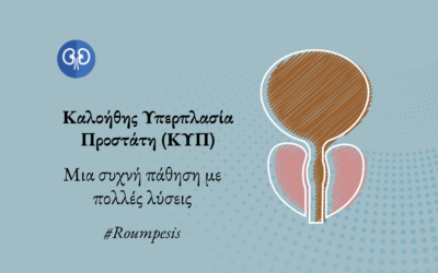 Καλοήθης Υπερπλασία Προστάτη (ΚΥΠ) – Μια συχνή πάθηση με πολλές λύσεις