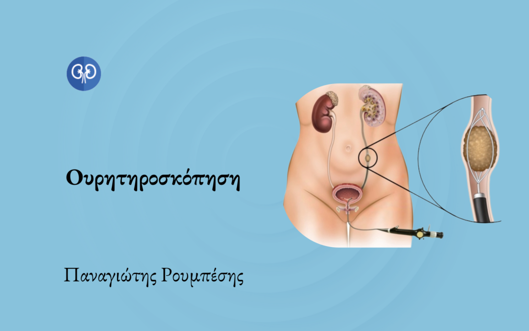 Ουρητηροσκόπηση – Τι είναι και πότε ενδείκνυται